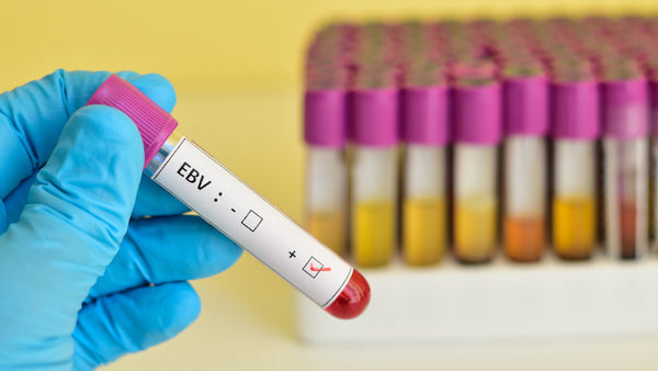 EBV-Virus Test positiv